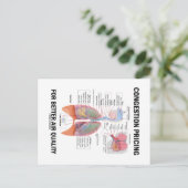 大気質の向上のための輻輳価格 ポストカード (スタンド正面)