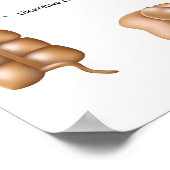 大腸の病理ポスター ポスター (角)