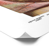 大腸解剖学 ポスター (角)