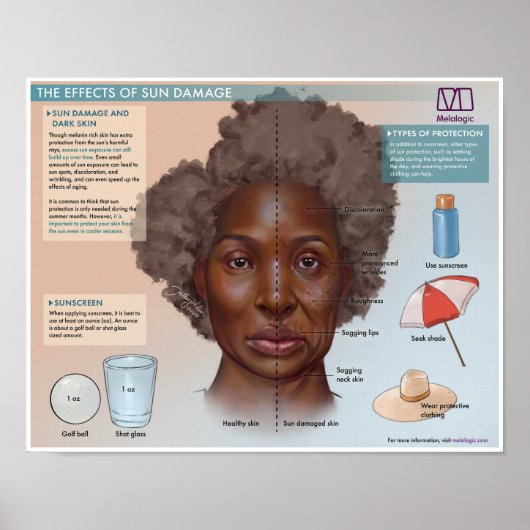 太陽被害医療ポスターの効果を伝える ポスター (正面)