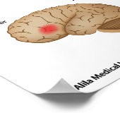 失読性脳活動ポスター ポスター (角)