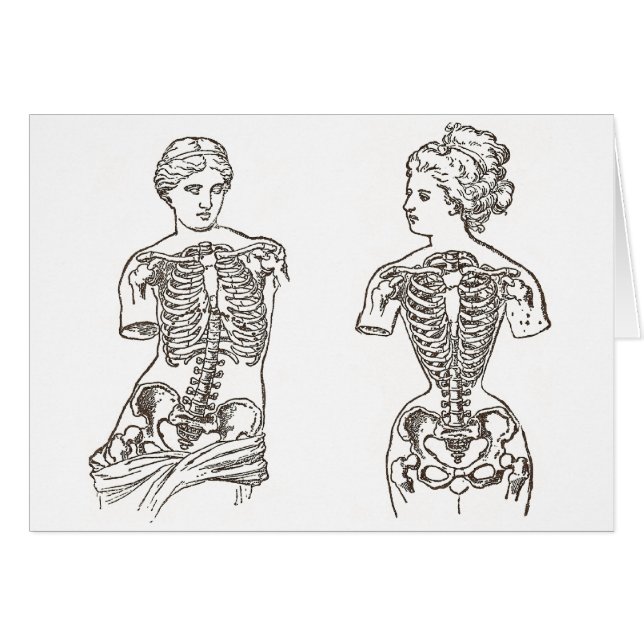 女性が美しいのためにいかに苦しむか: コルセットの影響 (正面横)