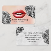 女性スマイル歯のホワイトニングデンタルケア 名刺 (正面/裏面)
