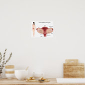 女性生殖系ポスター ポスター (キッチン)