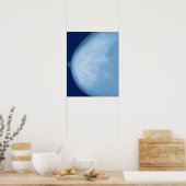 女性胸部のX線側面図 ポスター (キッチン)