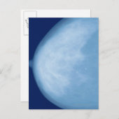 女性胸部のX線側面図 ポストカード (正面/裏面)