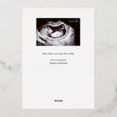 妊娠の発表クラシー金箔のオーバーレイ 箔シーズンカード (裏面)