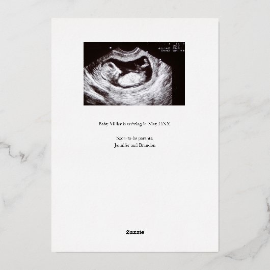 妊娠の発表クラシー金箔のオーバーレイ 箔シーズンカード (裏面)