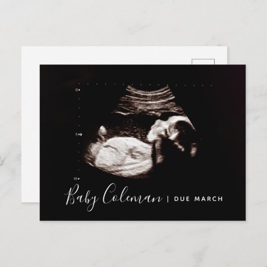 妊娠の発表ソノグラム期待はがき 案内ポストカード (正面/裏面)