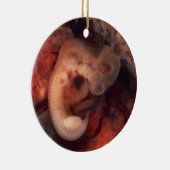 妊娠の第5かいま見のP.O.の人間胚の第7週 セラミックオーナメント (右)