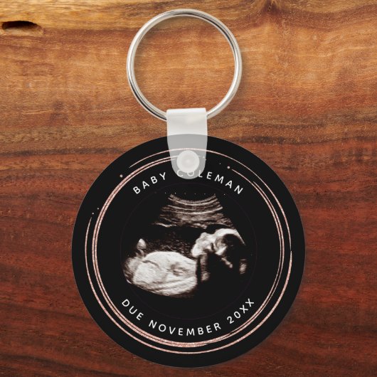 妊娠ピンクグリッターソノグラム超音波写真 キーホルダー (正面)