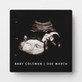 妊娠ベビーソノグラム超音波写真新しい母 フォトプラーク (正面)