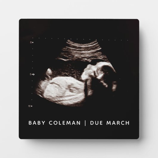 妊娠ベビーソノグラム超音波写真新しい母 フォトプラーク (正面)