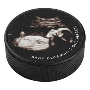妊娠ベビーソノグラム超音波写真 アイスホッケーパック