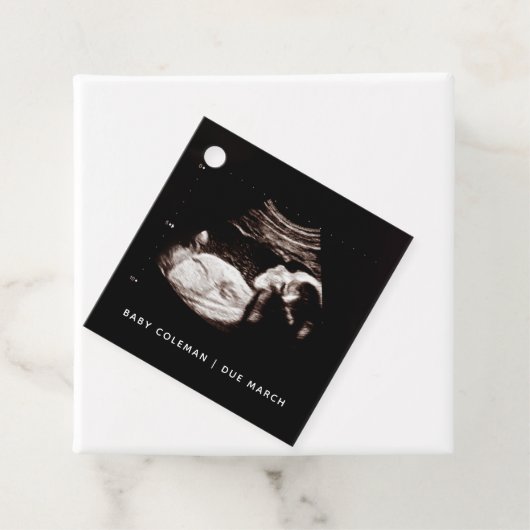 妊娠ベビーソノグラム超音波写真 フェイバータグ (インサイチュ)