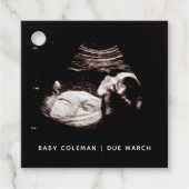 妊娠ベビーソノグラム超音波写真 フェイバータグ (正面)