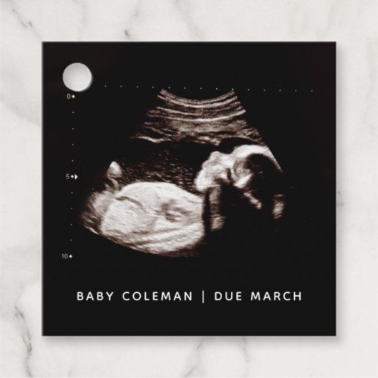 妊娠ベビーソノグラム超音波写真 フェイバータグ (正面)