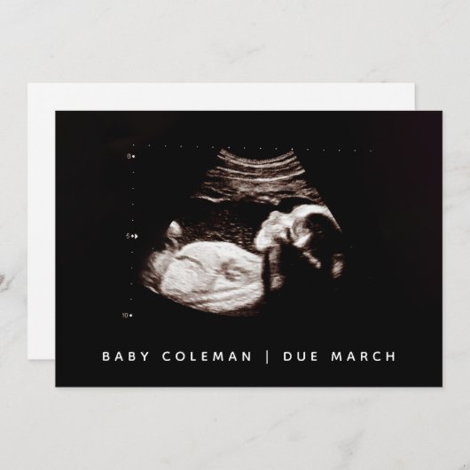 妊娠ベビー超音波写真カード 招待状 (正面/裏面)