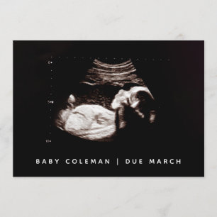 妊娠ベビー超音波写真カード 招待状