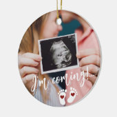 妊娠メリークリスマスベビー超音波写真 セラミックオーナメント (左)