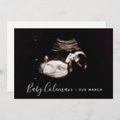 妊娠告知ソノグラムスクリプト名カード 案内状 (正面/裏面)