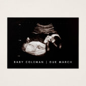 妊娠告知ソノグラムミニカードパック (正面)