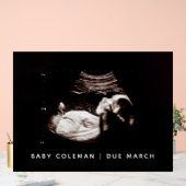 妊娠告知ベビーシャワーソノグラム アクリルサイン (ウェディング)