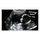 妊娠告知新生児ス来キャン近日 マグネット名刺 (正面)