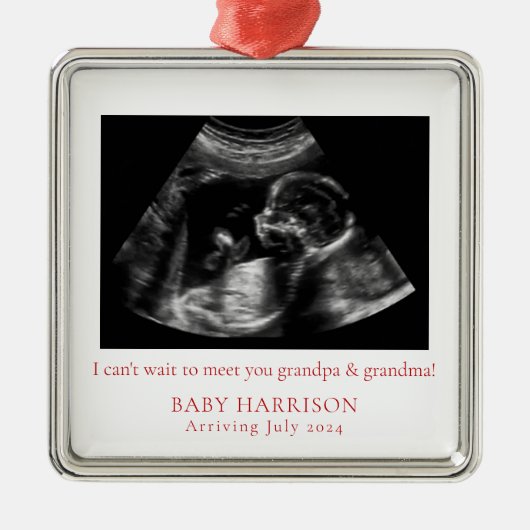 妊娠告知Ultrasound写真クリスマス メタルオーナメント (正面)
