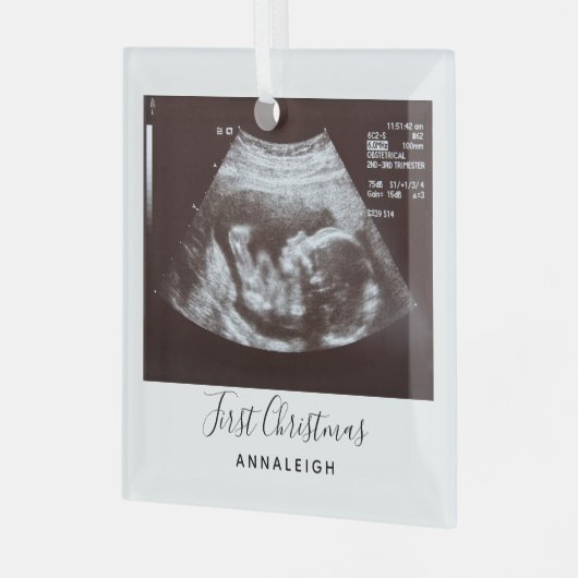妊娠超音波写真初めてのクリスマス休日 ガラスオーナメント (正面左)