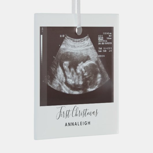 妊娠超音波写真初めてのクリスマス休日 ガラスオーナメント (正面右)
