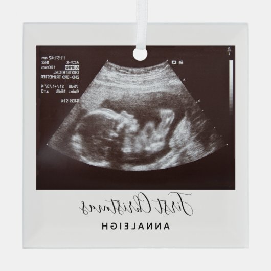 妊娠超音波写真初めてのクリスマス休日 ガラスオーナメント (裏面)