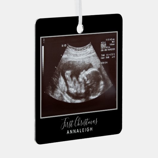妊娠超音波写真初めてのクリスマス休日 メタルオーナメント (正面右)