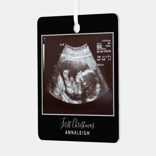 妊娠超音波写真初めてのクリスマス休日 メタルオーナメント (正面左)