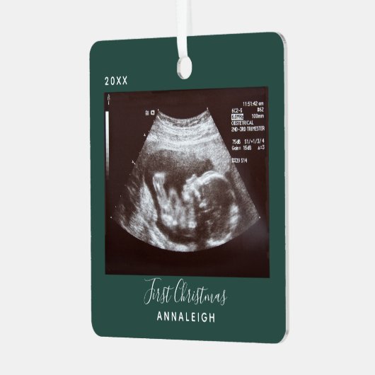 妊娠超音波写真初めてのクリスマス休日 メタルオーナメント (正面左)