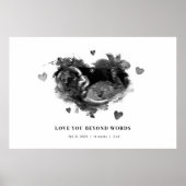 妊娠超音波発来表の発表 ポスター (正面)