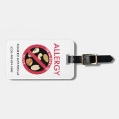 子供カスタムなピーナツ木のナットのアレルギーの緊急事態 ラゲッジタグ (正面横)