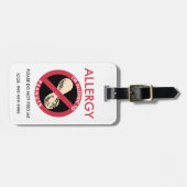 子供ピーナツにアレルギーカスタムなピーナツアレルギー ラゲッジタグ (正面横)