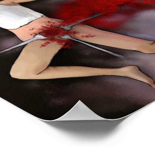 子宮摘出術 ポスター (角)