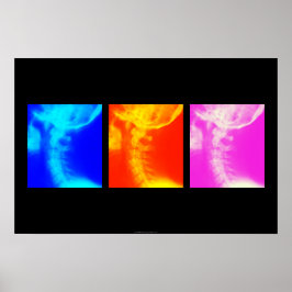 子宮頸X線カイロプラクティックポスター1 ポスター