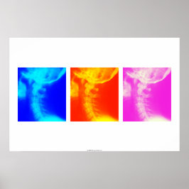 子宮頸X線カイロプラクティックポスター2 ポスター