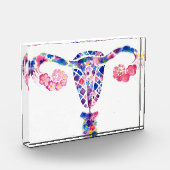 子宮 フォトブロック (左)