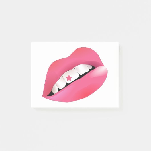 宝石で飾られる歯の胚は~をもたらきらきら光るす ポストイット (正面)