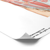 小さなポスター – Netter腹筋 ポスター (角)