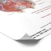 小さなポスター – Netter's Pelvic Diampharb ポスター (角)