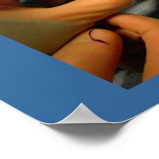 小児手外科 ポスター (角)