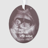 少し奇跡2の写真のベビーが発表する超音波 オーナメント (正面)