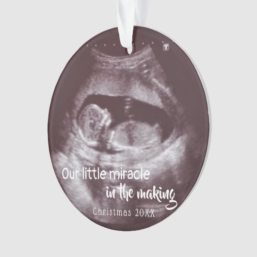 少し奇跡2の写真のベビーが発表する超音波 オーナメント (正面)