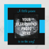 少年ベビーカスタマイズ超音写真テンプレート 招待状 (正面/裏面)