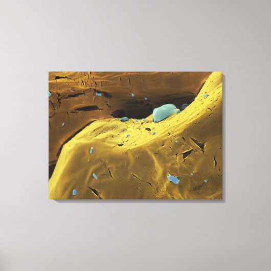 尿素粉末 キャンバスプリント (正面)